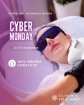 Cyber · HIFU Rostro Completo