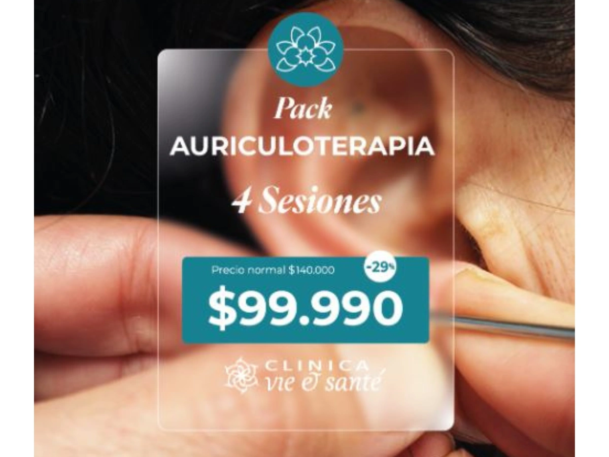 Pack Auriculoterapia 4 Sesiones