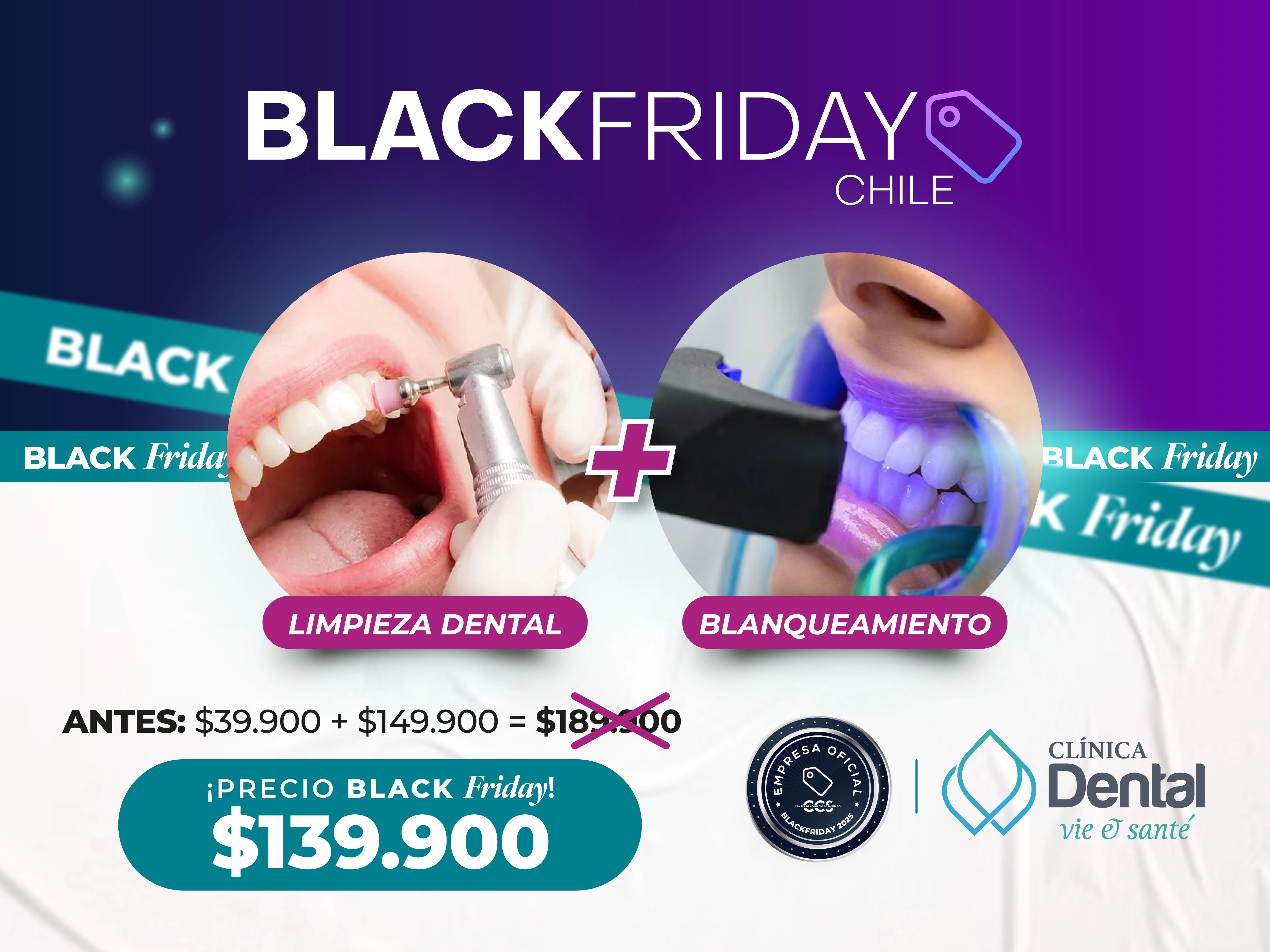 Limpieza + Blanqueamiento