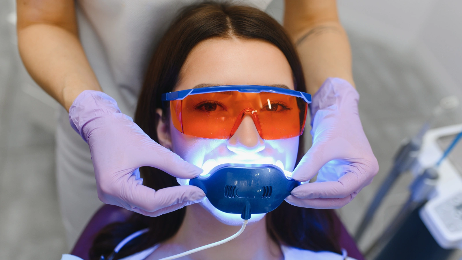 Estética y prevención dental