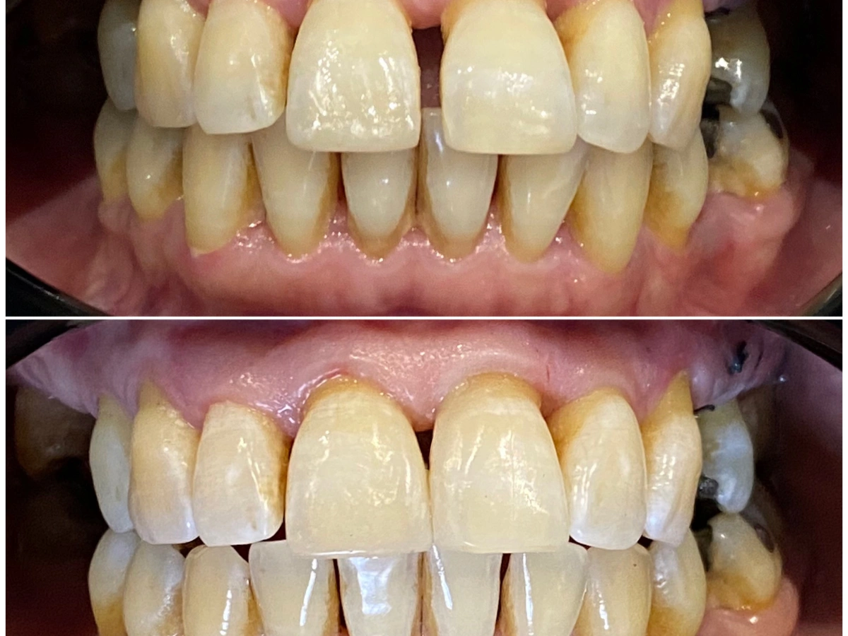 Después rehabilitación oral