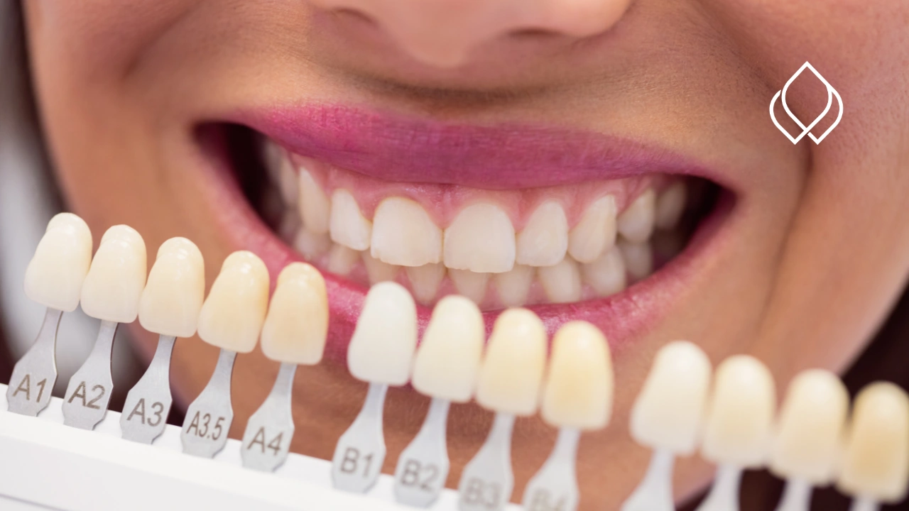 Rehabilitación oral Clínica Vie et Santé