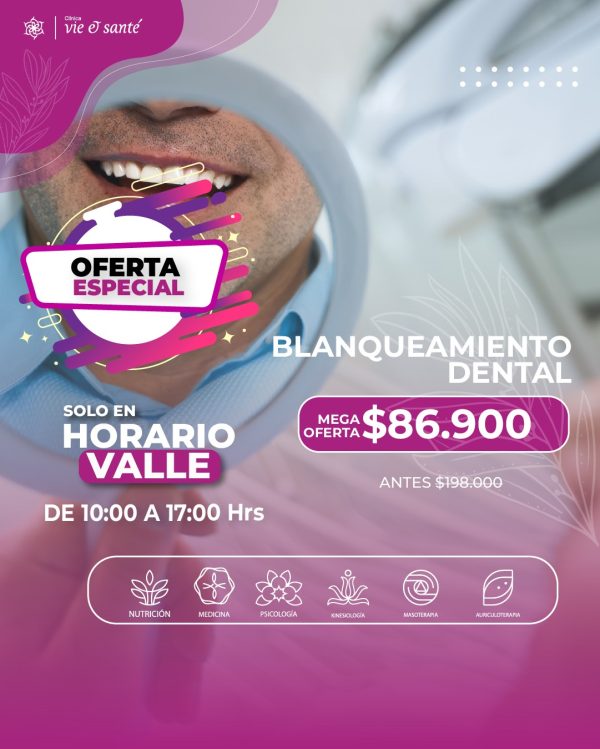 Blanqueamiento dental