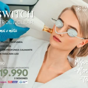 Q Switch Control & Clear – Tratamiento Facial Avanzado para Piel Radiante